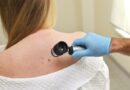 Precisan diagnósticos de cáncer de piel de tipo melanoma con Inteligencia Artificial